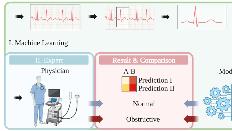 Machine Learning Approach on High Risk Treadmill Exercise Test to Predict Obstructive Coronary Artery Disease by using P, QRS, and T waves’ Features