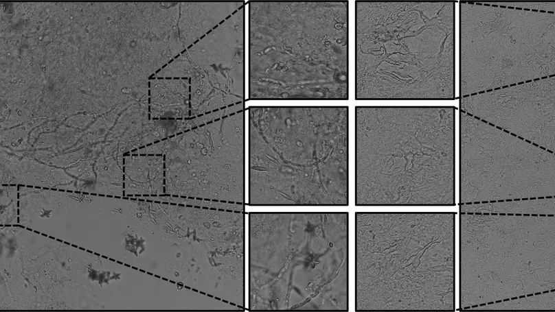 Deep convolutional neural networks for onychomycosis detection using microscopic images with KOH examination